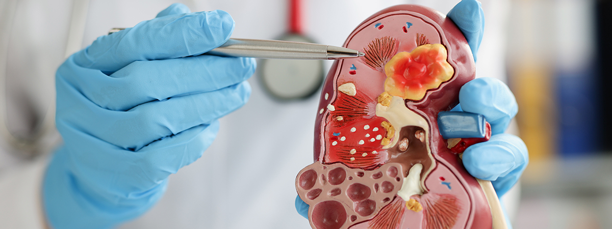 Radical Cholecystectomy - Services - Hope & Heal Cancer Hospital and Research Center