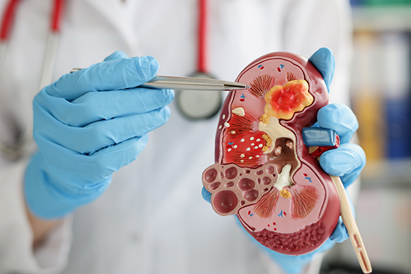 Radical Cholecystectomy - Services - Hope & Heal Cancer Hospital and Research Center