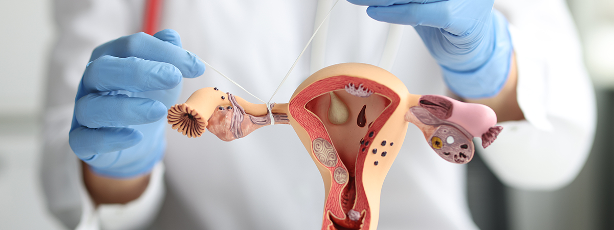 Radical Hysterectomy - Services - Hope & Heal Cancer Hospital and Research Center