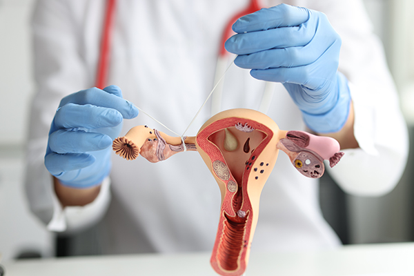 Radical Hysterectomy - Services - Hope & Heal Cancer Hospital and Research Center