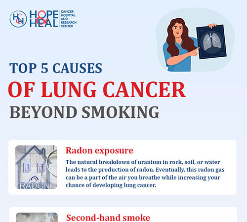 Top 5 Causes of Lung Cancer Beyond Smoking