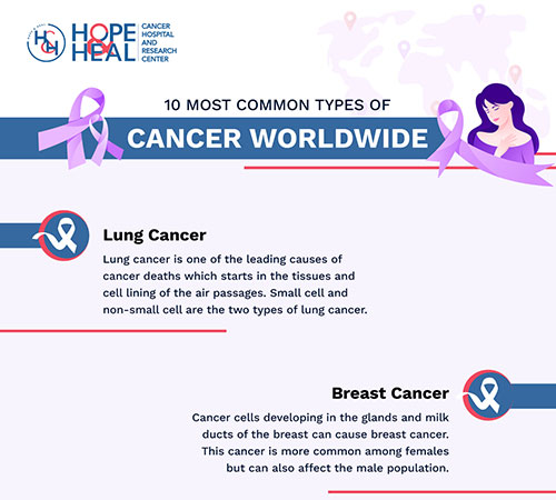 10 Most Common Types of Cancer Worldwide