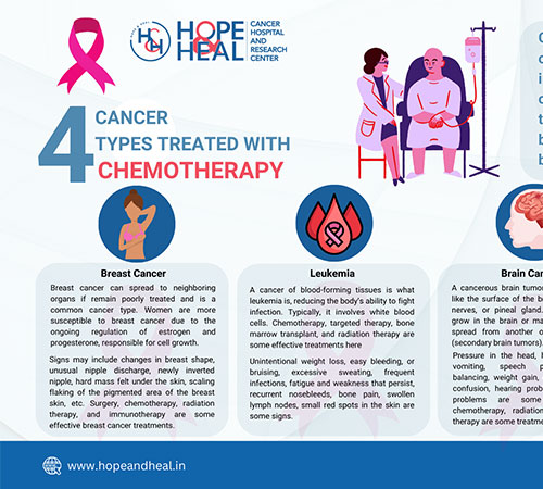 4 Cancer Types Treated with Chemotherapy