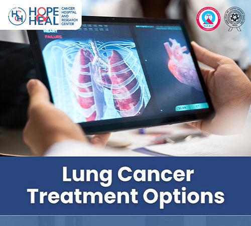 Lung Cancer Treatment Options